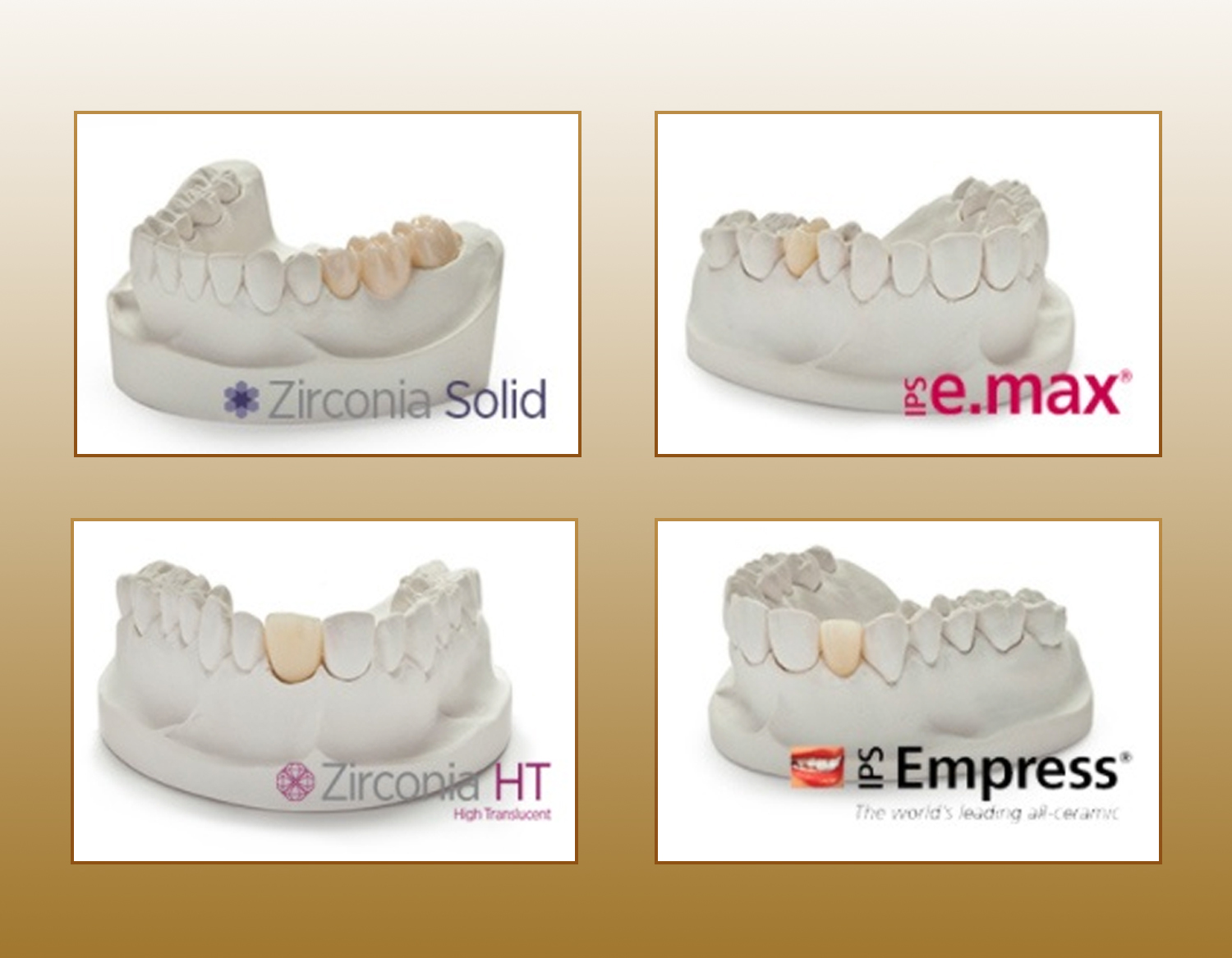dental-crown-materials