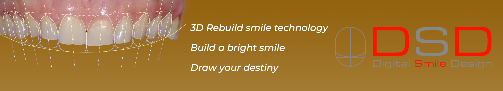 3D-rebuild-smile-technology